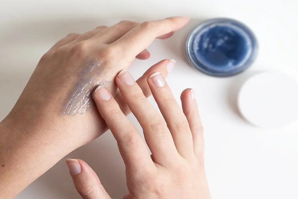 پیلینگ شیمیایی یک روش درمانی است که در آن از اسیدهای خاصی برای لایه‌برداری سطحی پوست استفاده می‌شود.