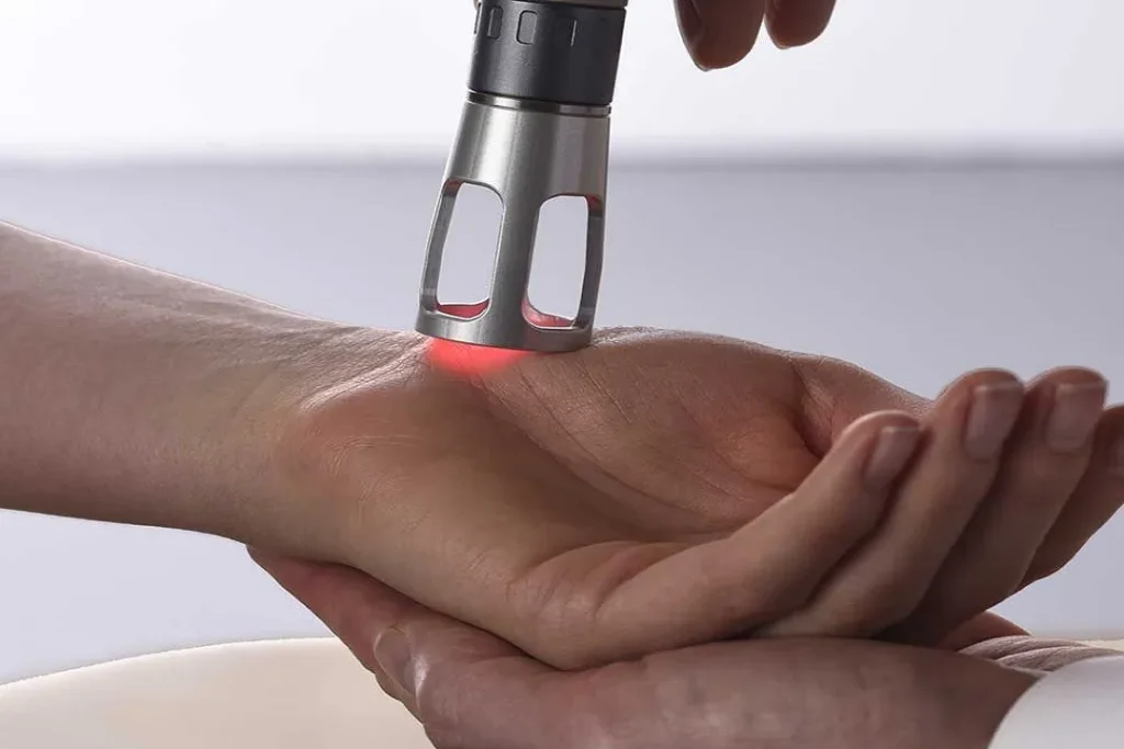 لیزر درمانی یکی از موثرترین روش‌ها برای کاهش لک‌های پیری است.