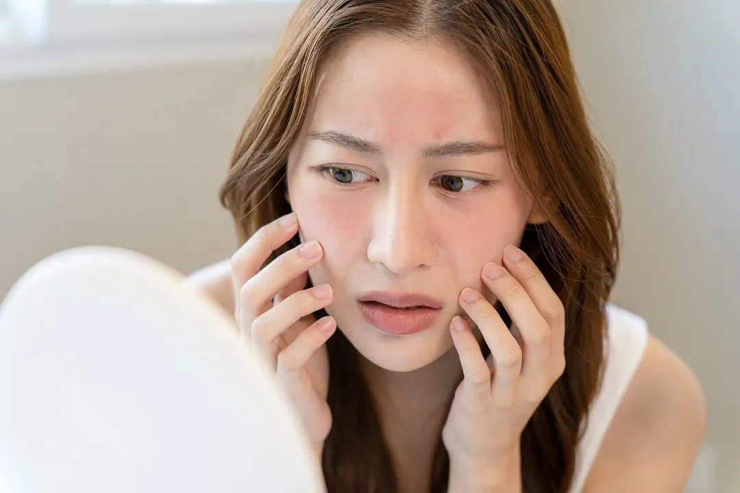 پوست حساس ممکن است به راحتی دچار قرمزی، التهاب یا خارش شود.