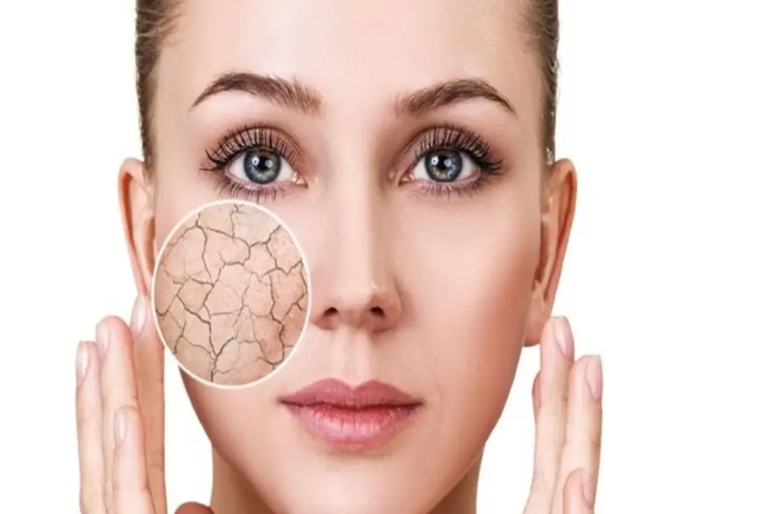 مراقبت از پوست در فصل سرما نیازمند توجه ویژه و استفاده از محصولات مناسب است.