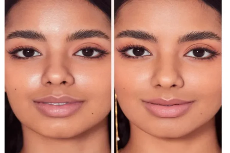 مات‌کننده پوست