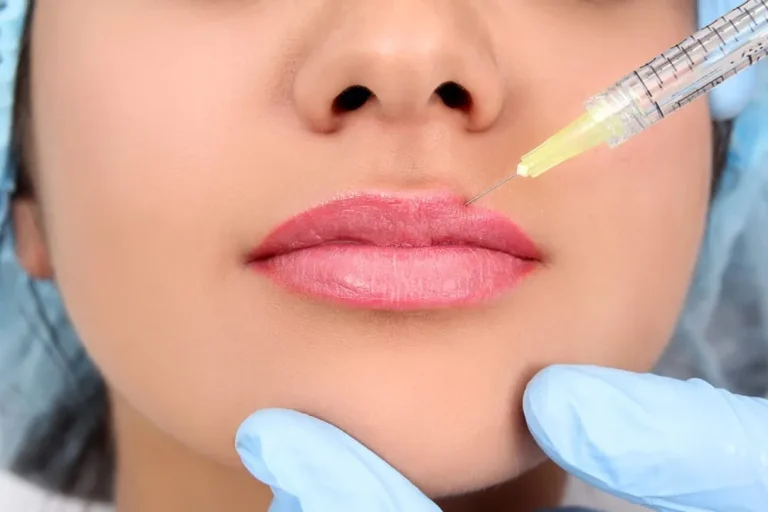 همه چیز درباره حجم‌دهی لب‌ها