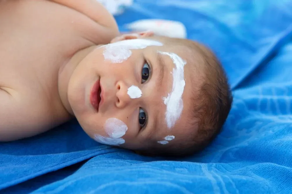 برای کودکان بالای ۶ ماه، استفاده از ضد آفتاب با SPF مناسب ضروری است